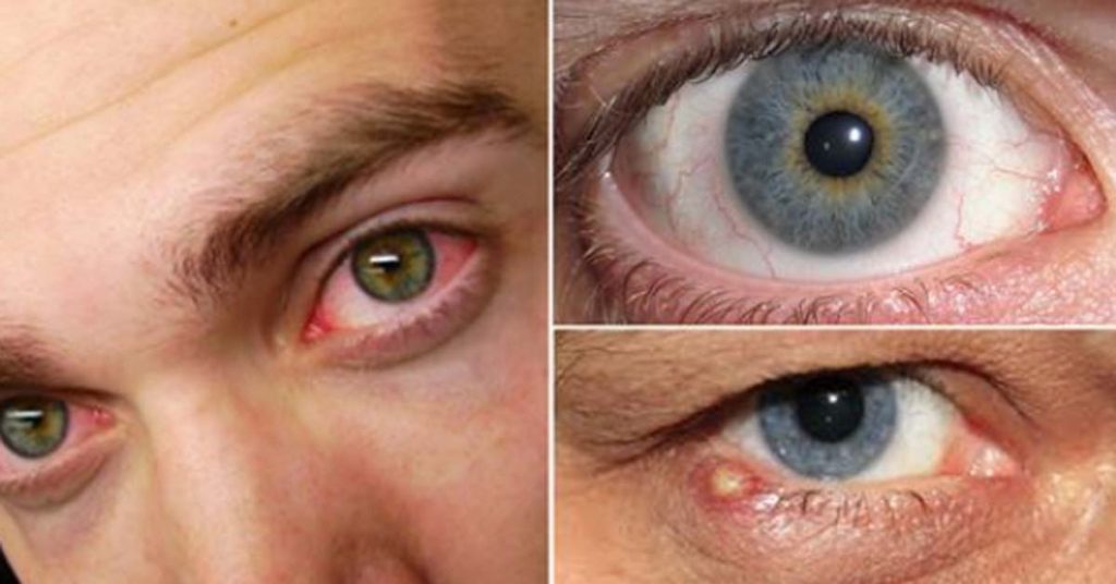 12 chorób, które łatwo rozpoznać po spojrzeniu w oczy.